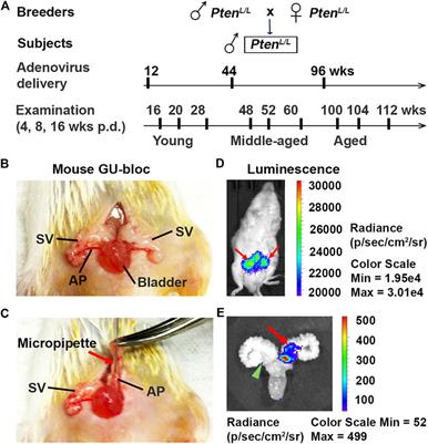 A Novel Controlled PTEN-Knockout Mouse Model for Prostate Cancer Study